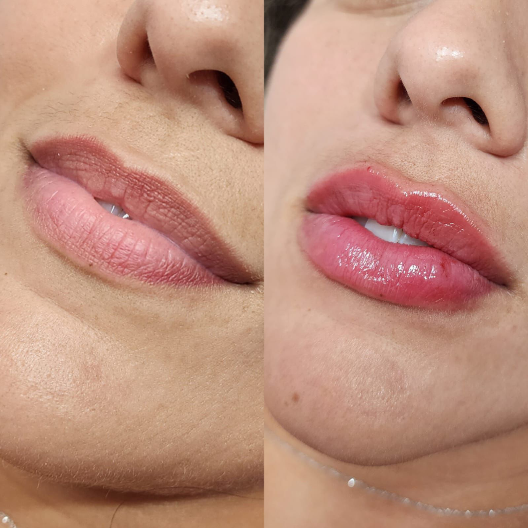 Antes de Depois 02